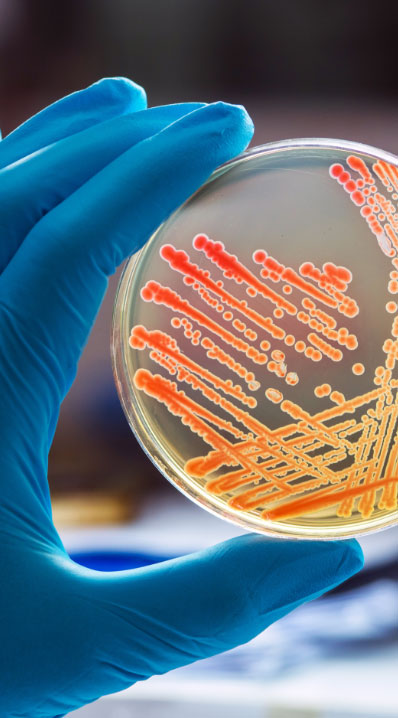 pathogen culture in a petri dish